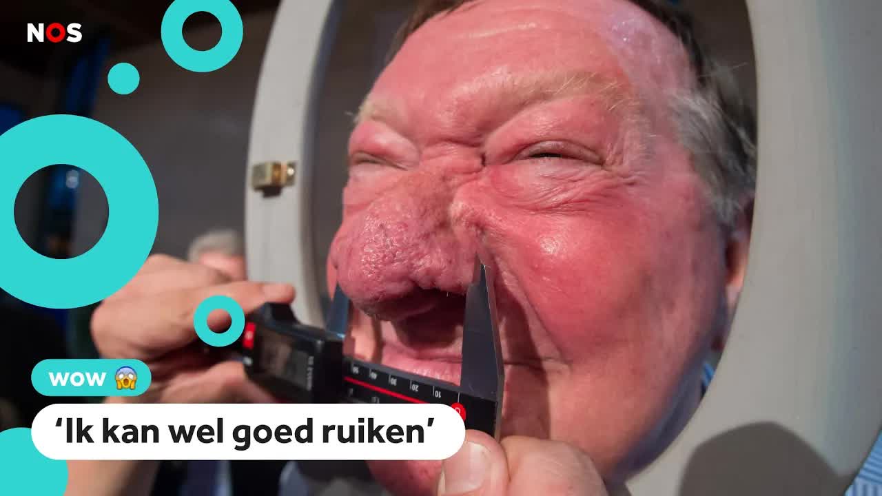 Hans heeft de grootste neus ter wereld