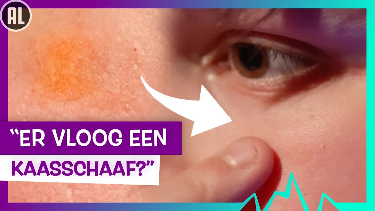HOE KOMT NAUD AAN ZIJN LITTEKEN? | TOPDOKS